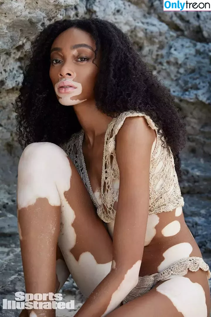 Winnie Harlow nude photo #0103 (winnieharlow)