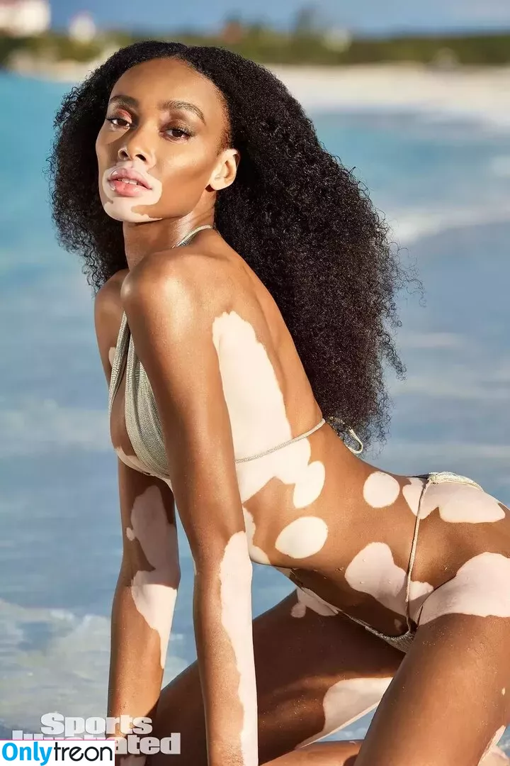 Winnie Harlow nude photo #0105 (winnieharlow)