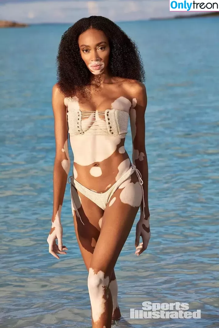 Winnie Harlow голая photo #0109 (winnieharlow)