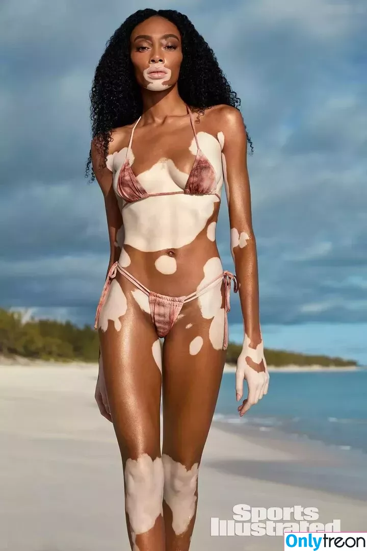 Winnie Harlow nude photo #0111 (winnieharlow)