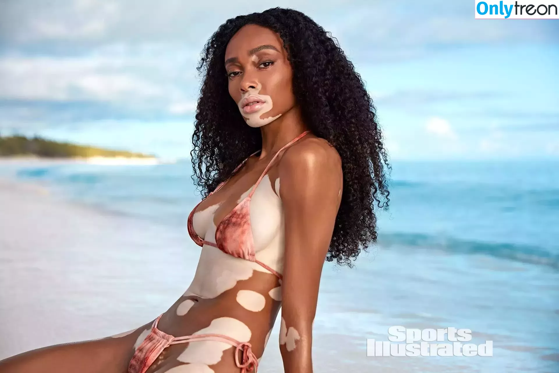 Winnie Harlow nude photo #0115 (winnieharlow)