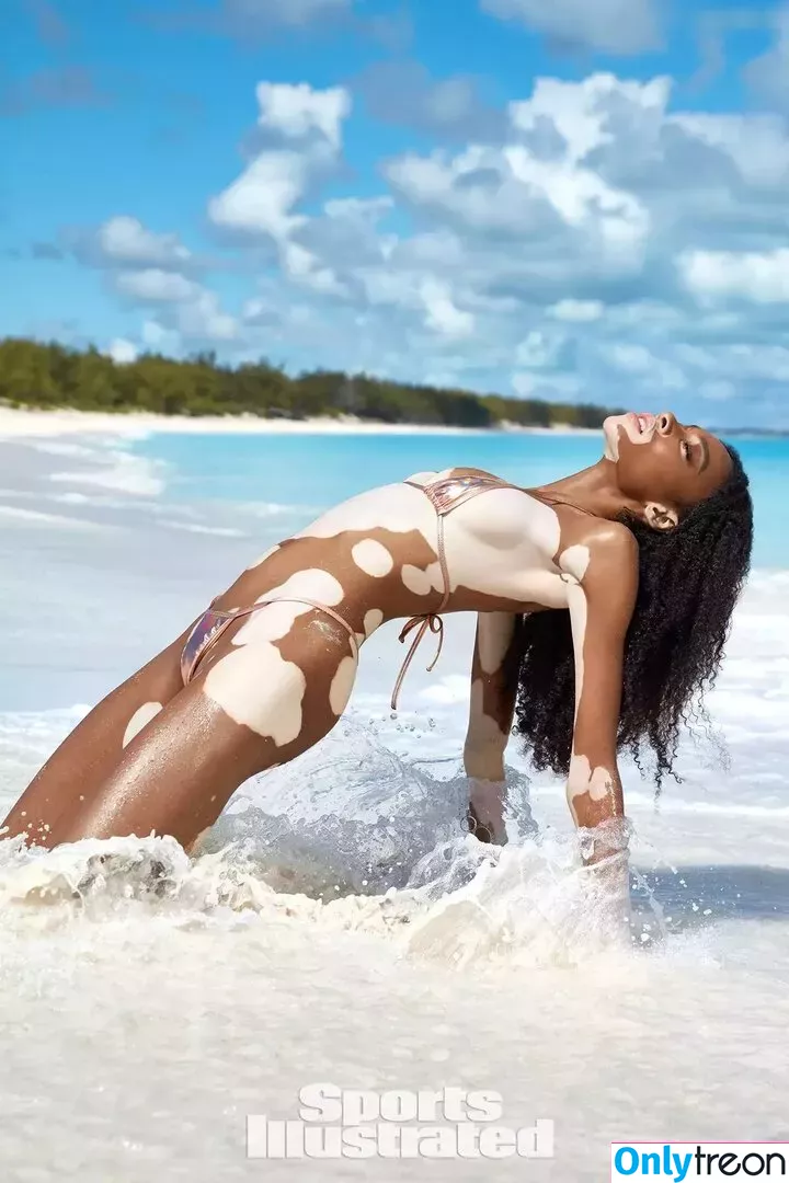 Winnie Harlow nude photo #0119 (winnieharlow)