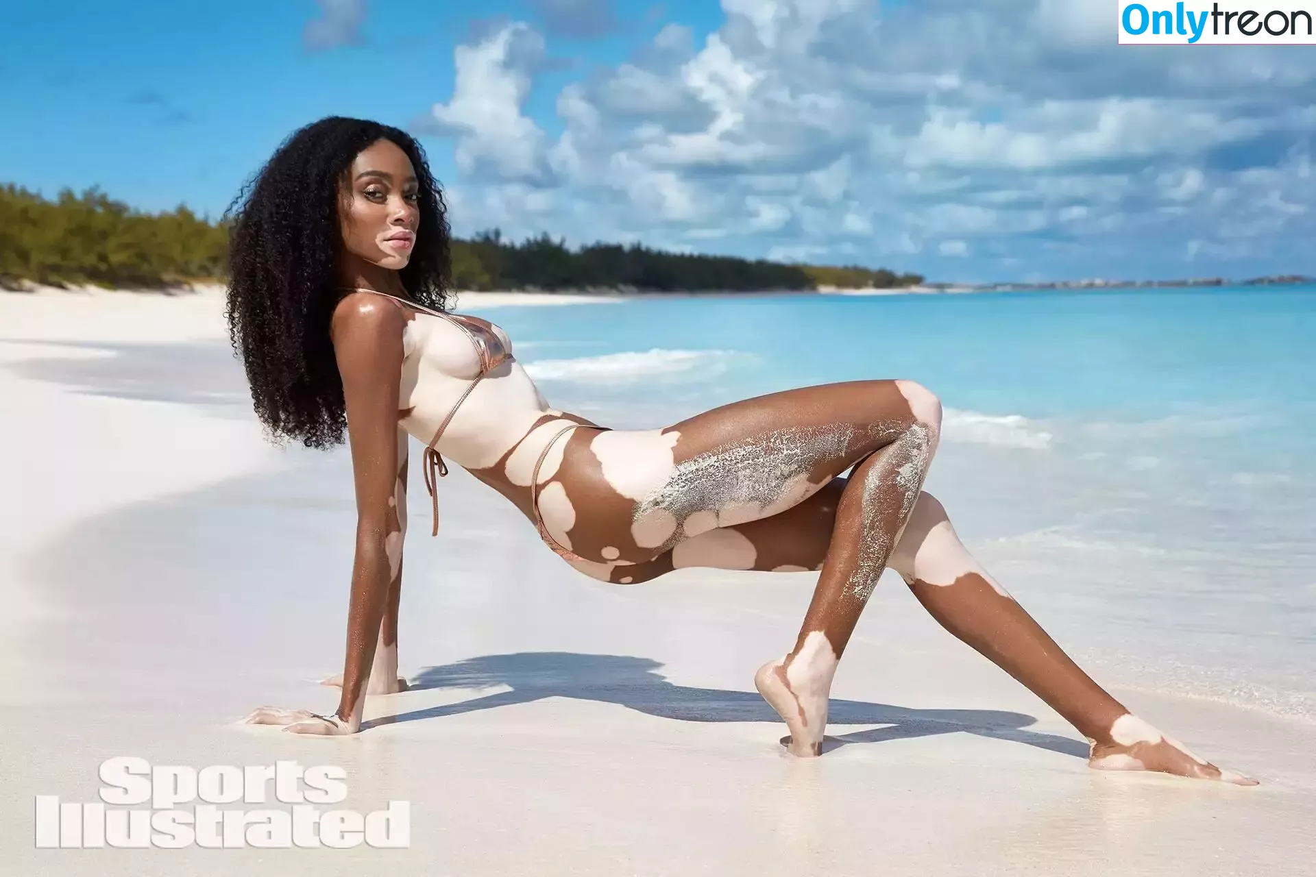 Winnie Harlow nude photo #0121 (winnieharlow)