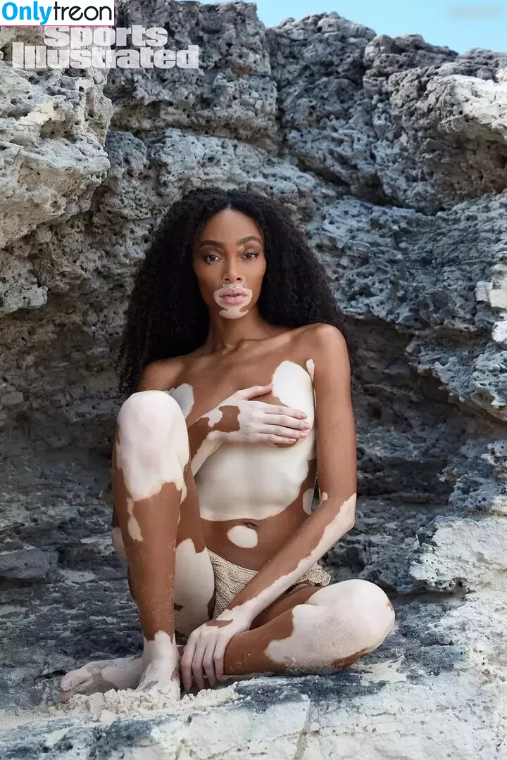 Winnie Harlow nude photo #0125 (winnieharlow)