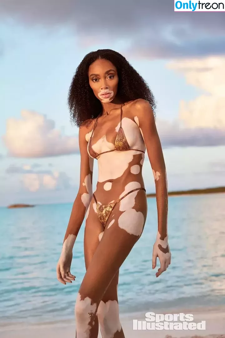 Winnie Harlow nude photo #0132 (winnieharlow)