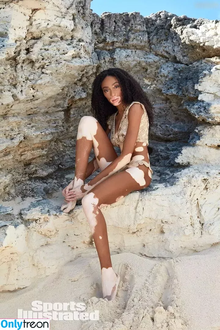 Winnie Harlow nude photo #0136 (winnieharlow)