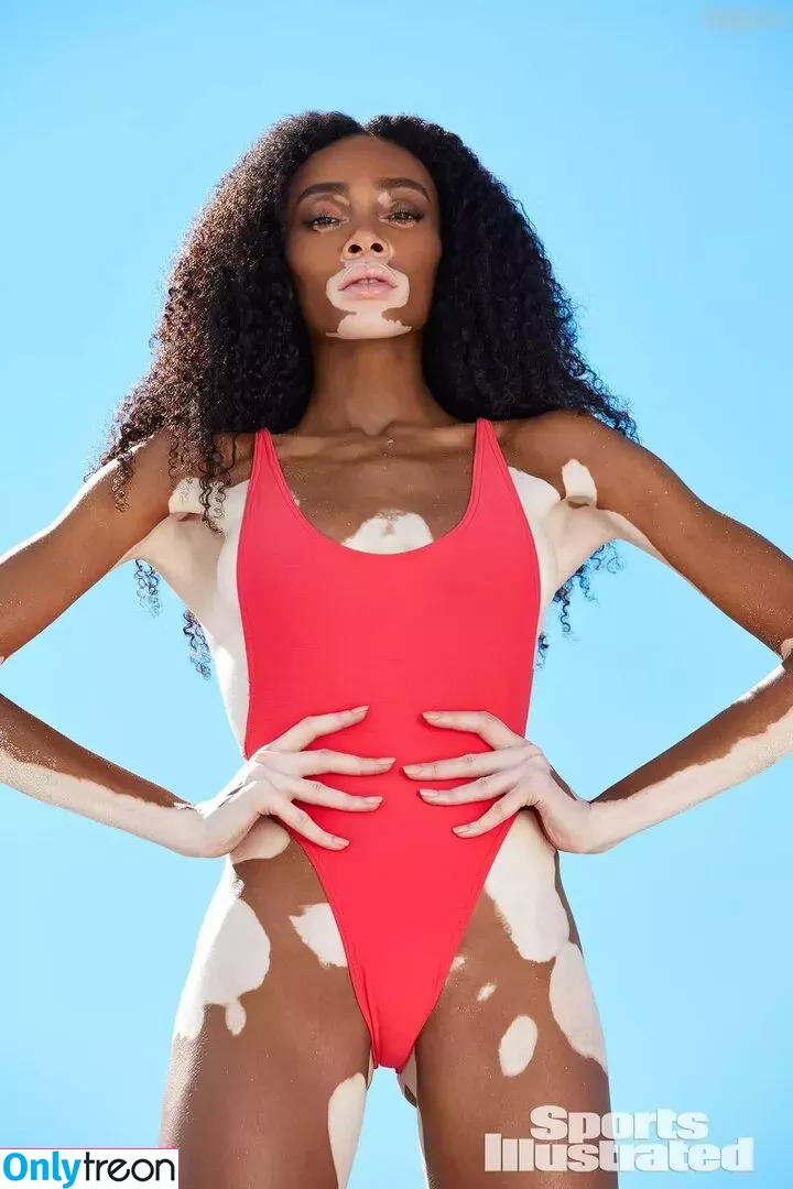 Winnie Harlow nude photo #0137 (winnieharlow)