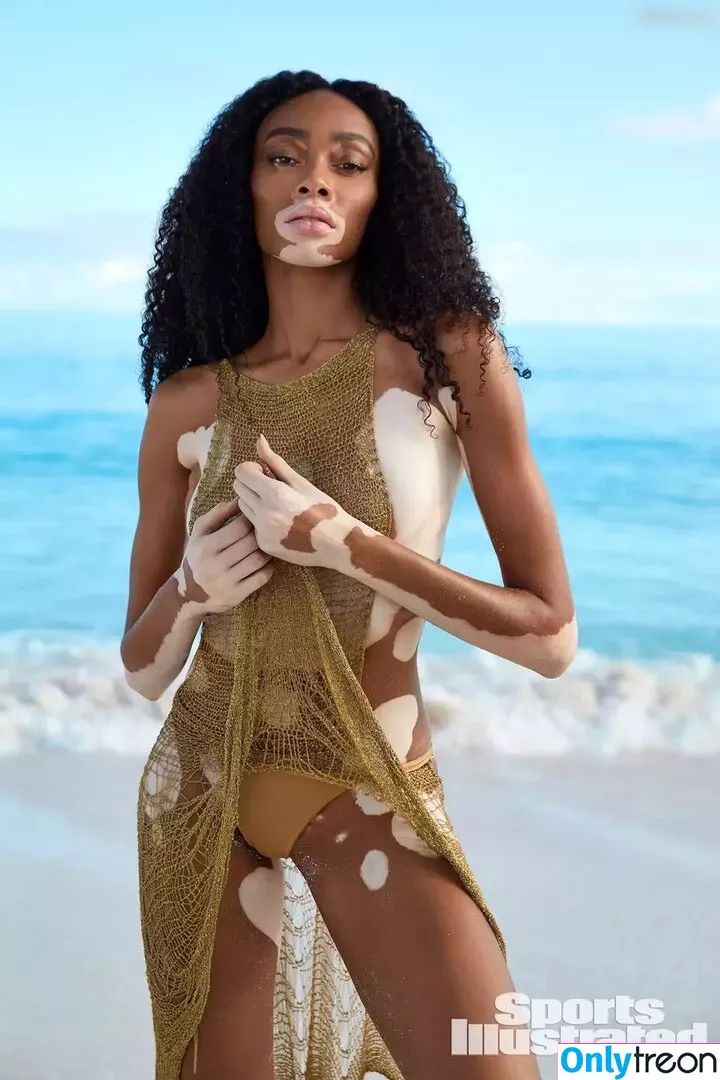 Winnie Harlow голая photo #0141 (winnieharlow)