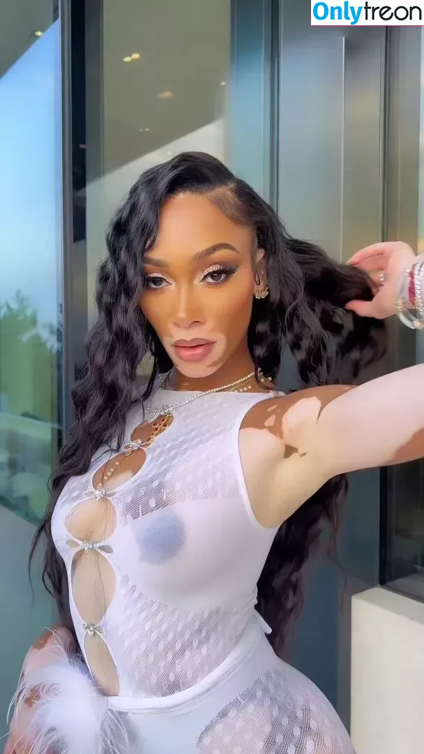 Winnie Harlow nude photo #0144 (winnieharlow)