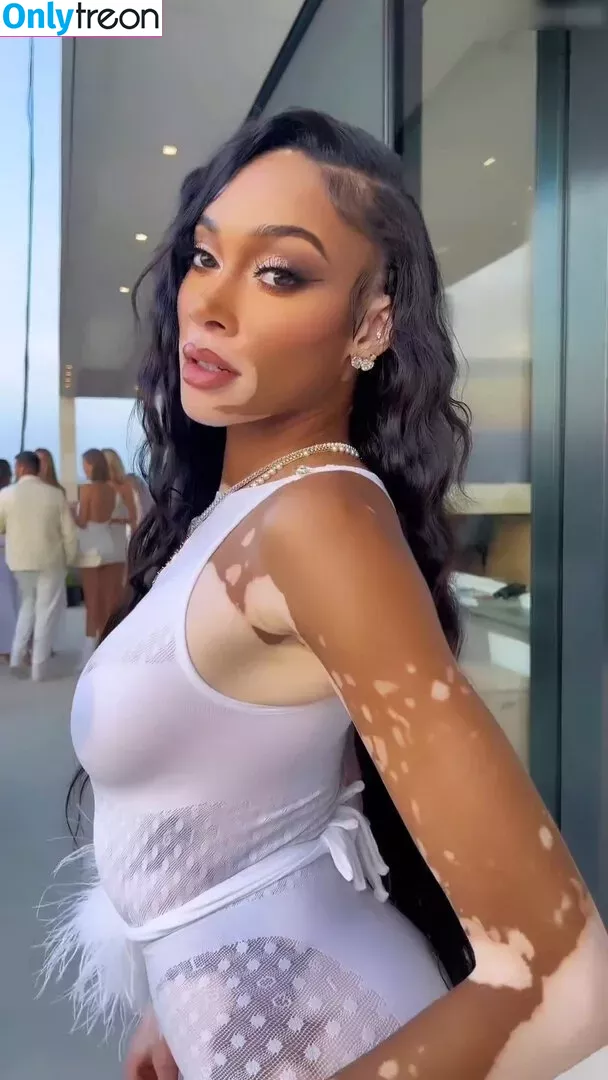Winnie Harlow голая photo #0145 (winnieharlow)