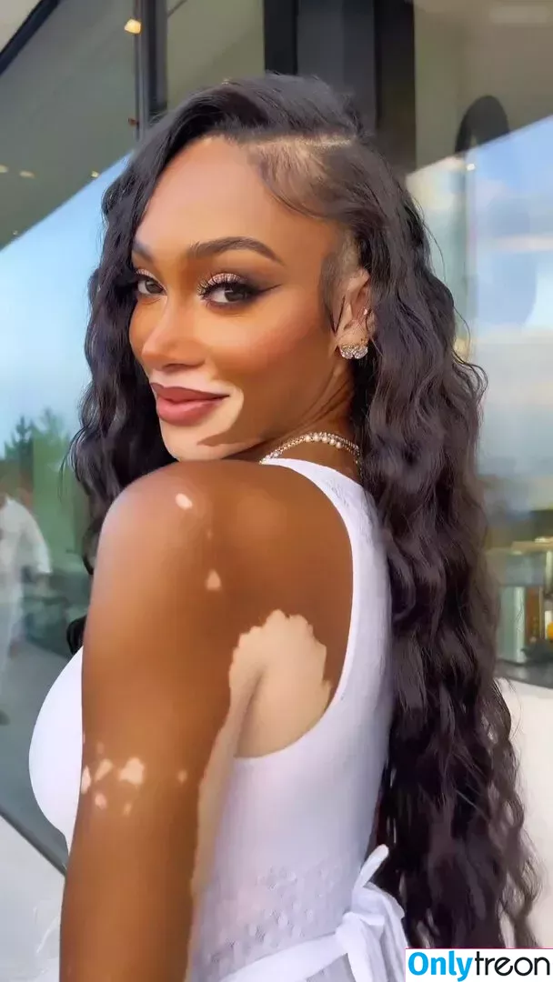 Winnie Harlow nude photo #0150 (winnieharlow)