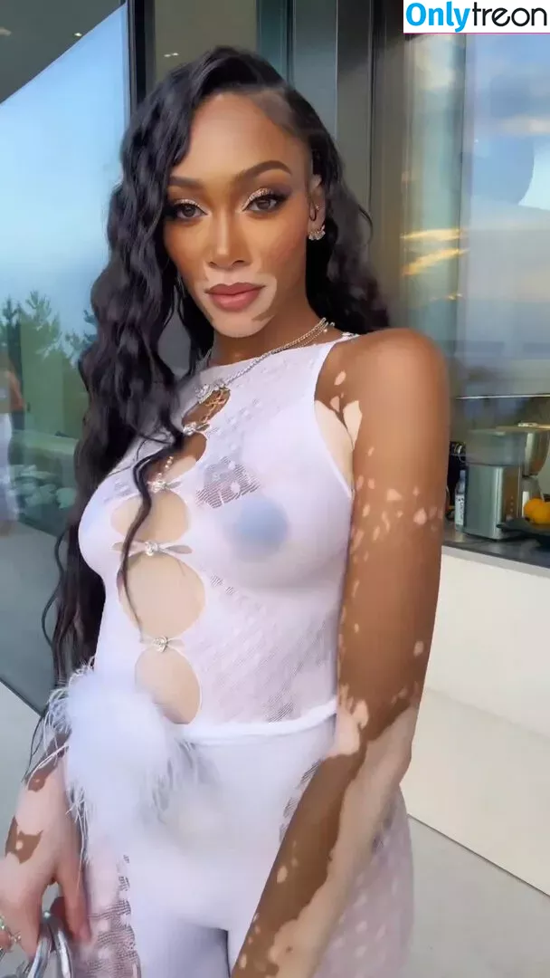 Winnie Harlow голая photo #0151 (winnieharlow)