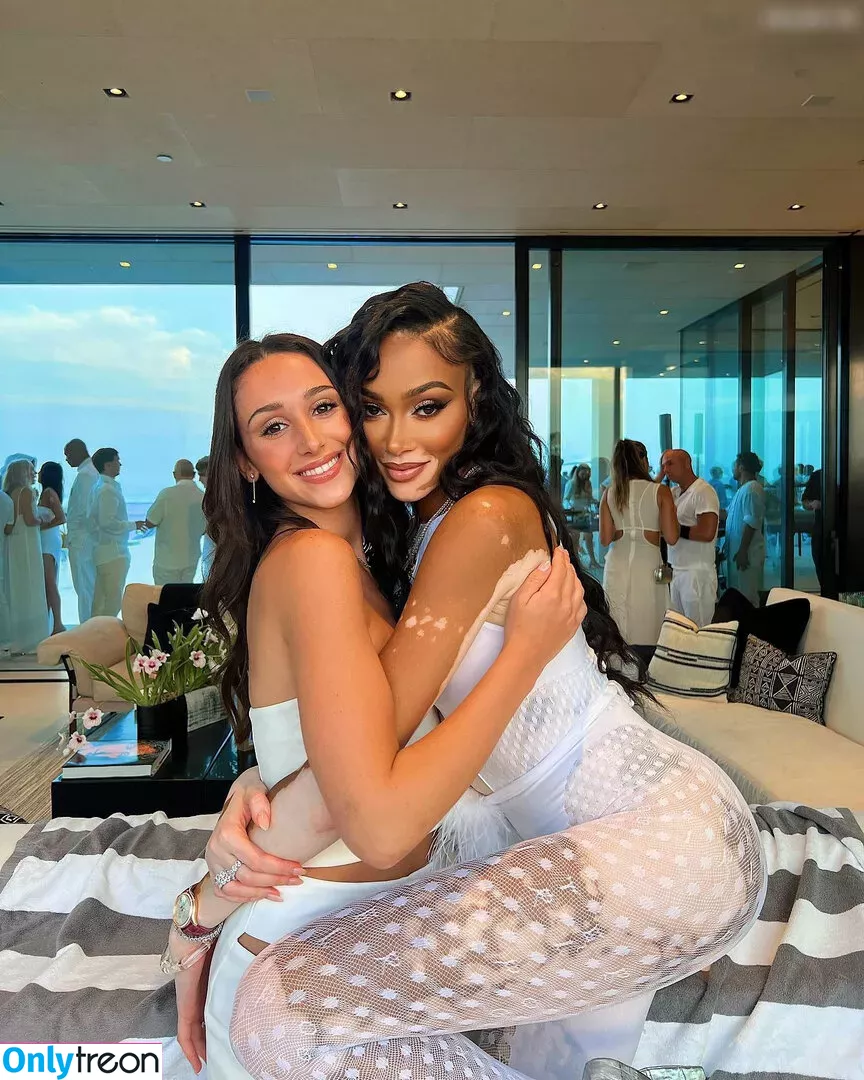 Winnie Harlow nude photo #0155 (winnieharlow)