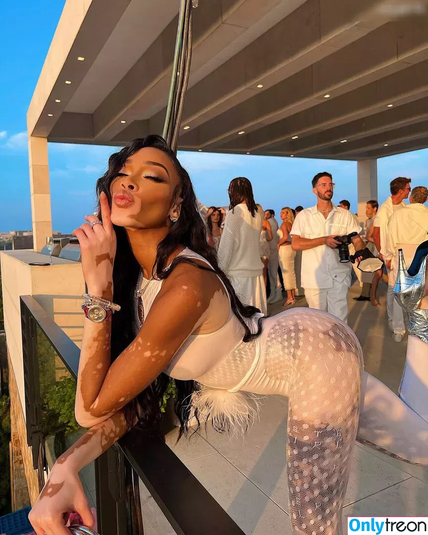 Winnie Harlow nude photo #0157 (winnieharlow)