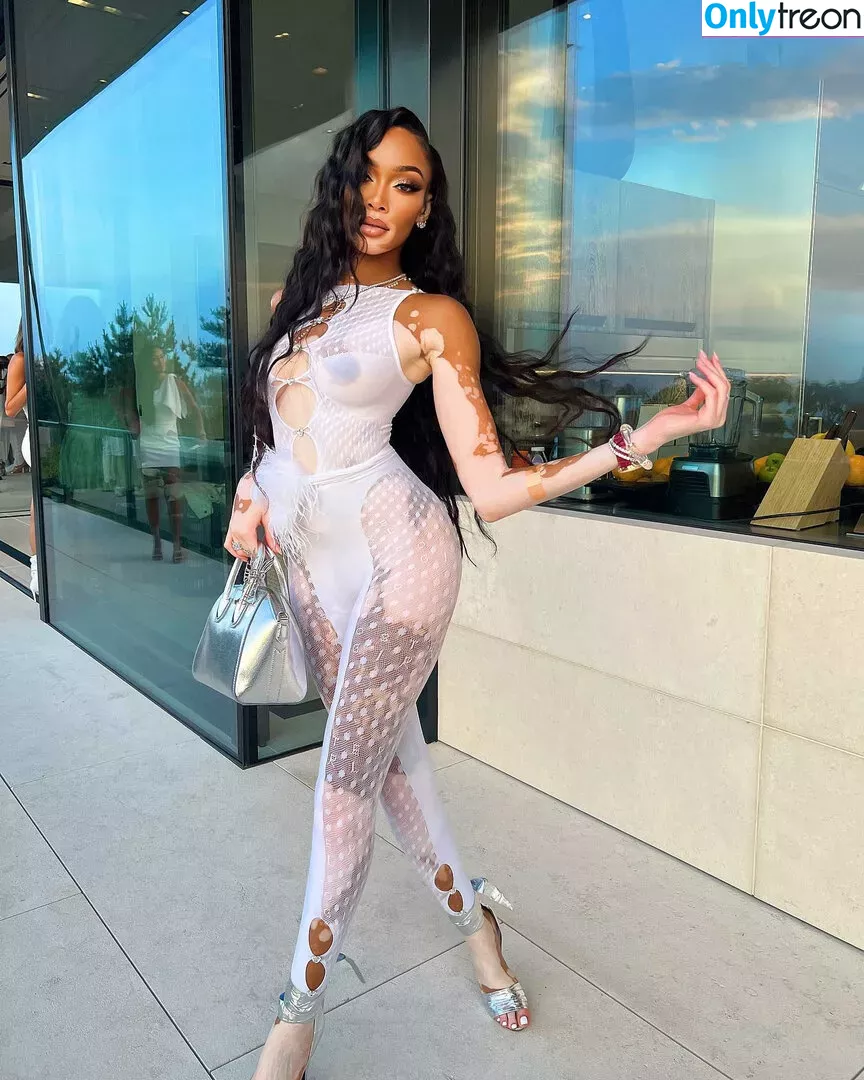 Winnie Harlow голая photo #0158 (winnieharlow)