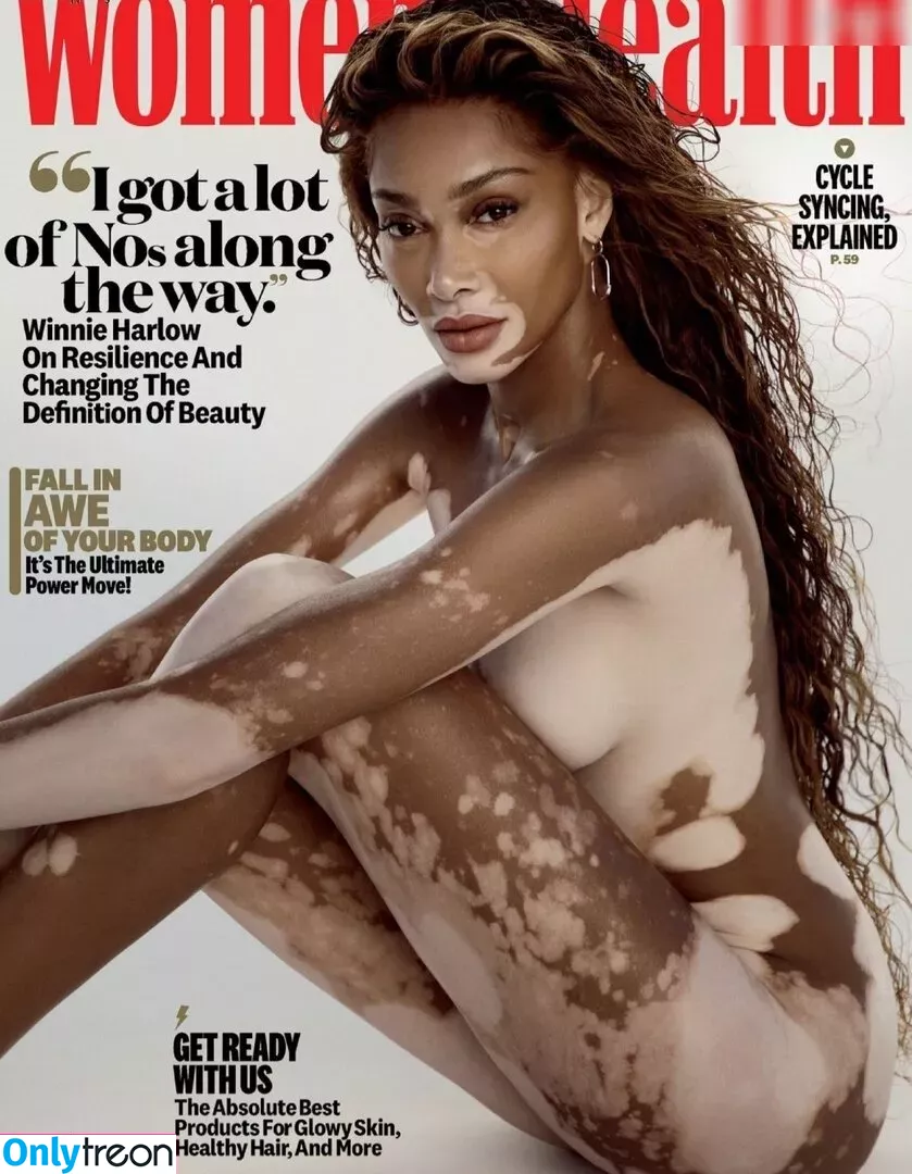 Winnie Harlow голая photo #0160 (winnieharlow)