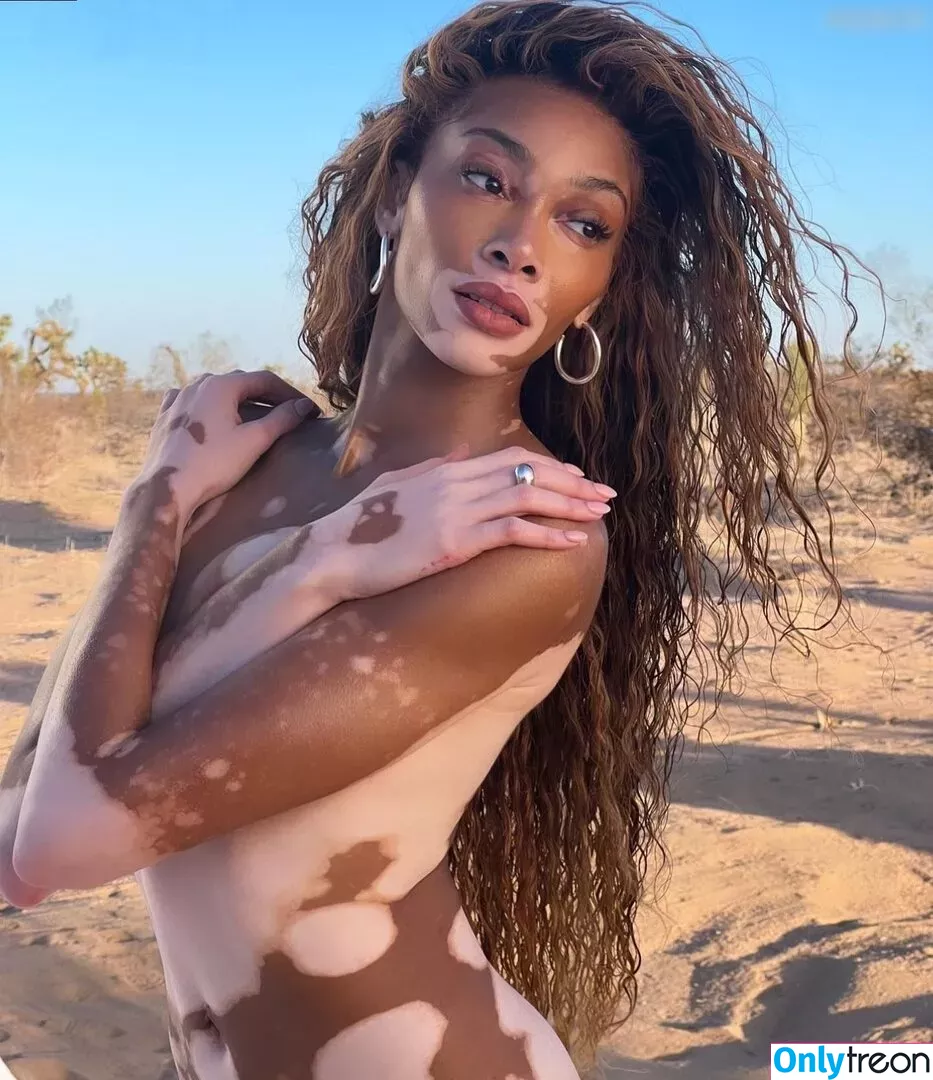 Winnie Harlow nude photo #0163 (winnieharlow)