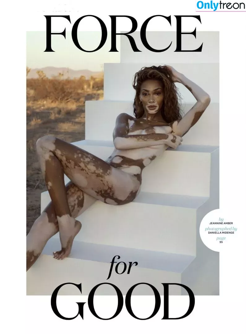 Winnie Harlow голая photo #0166 (winnieharlow)