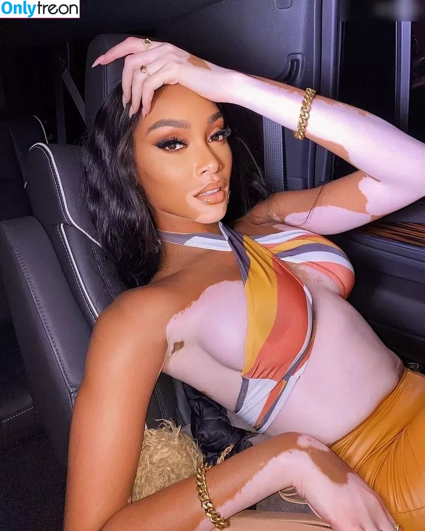 Winnie Harlow nude photo #0171 (winnieharlow)