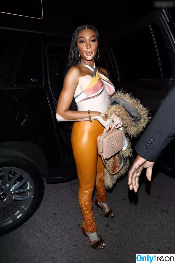 Winnie Harlow nude photo #0172 (winnieharlow)