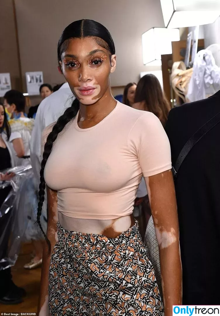 Winnie Harlow nude photo #0173 (winnieharlow)