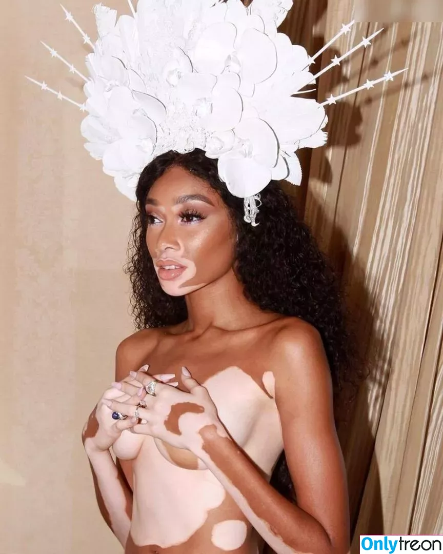 Winnie Harlow nude photo #0176 (winnieharlow)