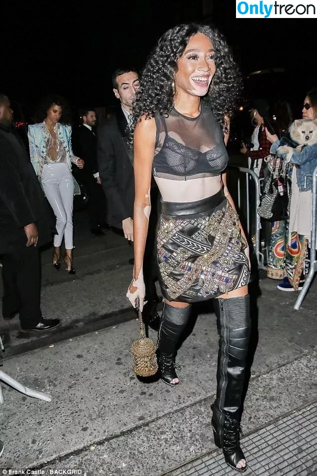 Winnie Harlow nude photo #0177 (winnieharlow)