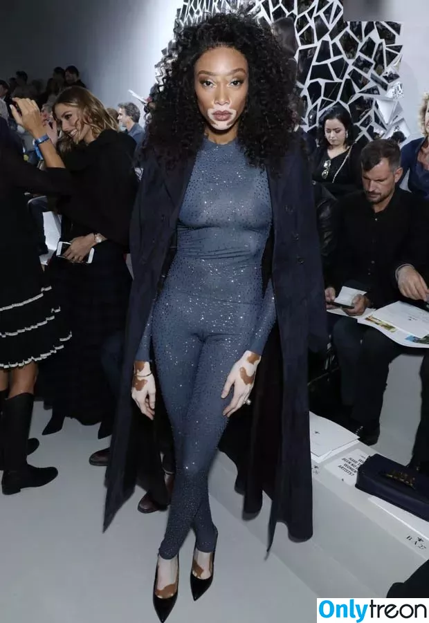 Winnie Harlow nude photo #0178 (winnieharlow)