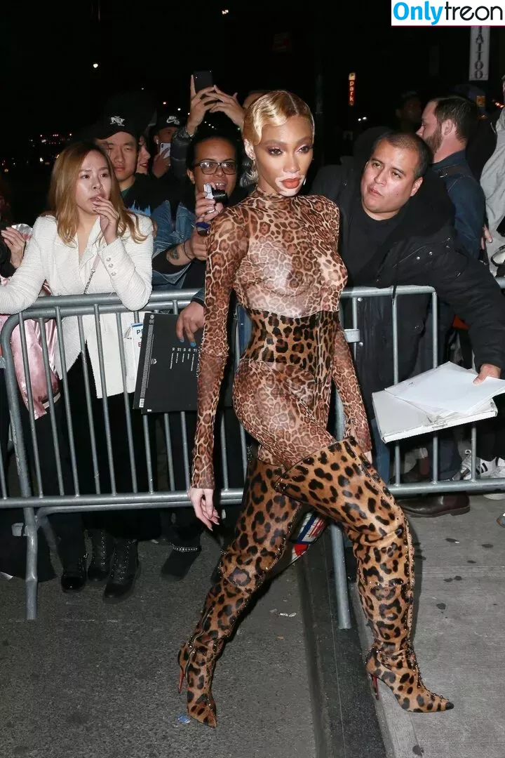 Winnie Harlow nude photo #0181 (winnieharlow)