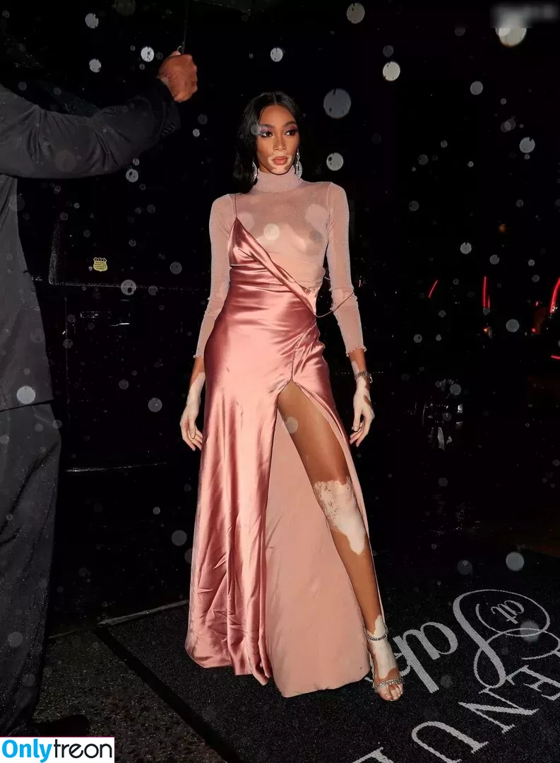Winnie Harlow nude photo #0184 (winnieharlow)