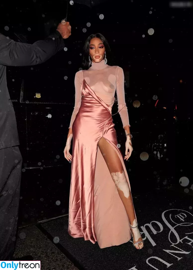 Winnie Harlow голая photo #0185 (winnieharlow)