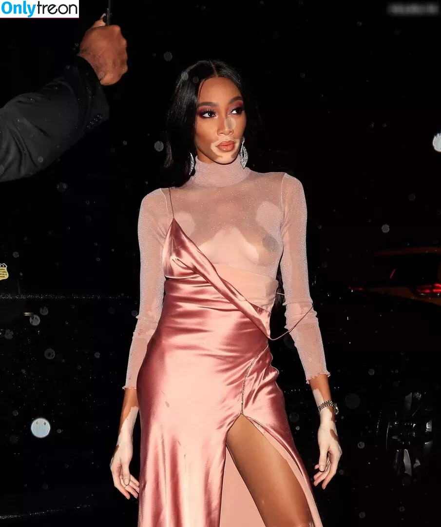 Winnie Harlow nude photo #0186 (winnieharlow)