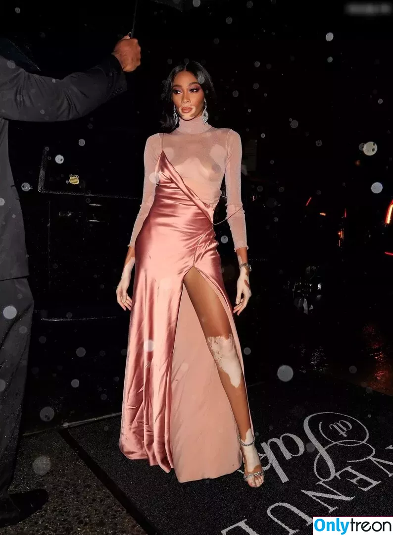 Winnie Harlow nude photo #0188 (winnieharlow)