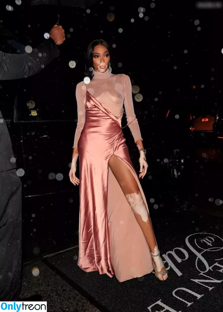 Winnie Harlow nude photo #0189 (winnieharlow)