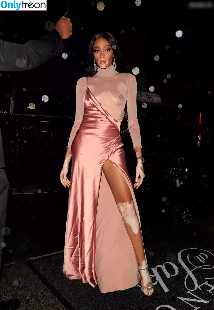 Winnie Harlow nude photo #0195 (winnieharlow)