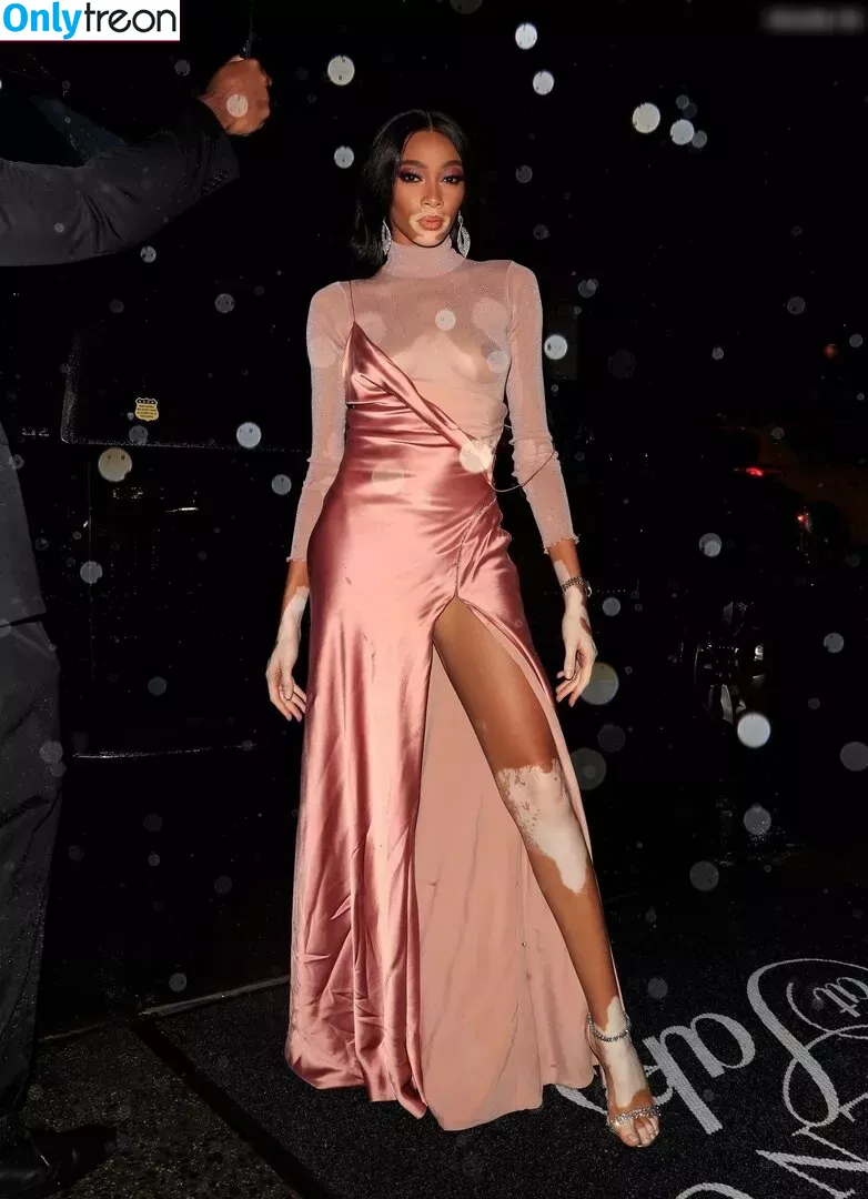 Winnie Harlow nude photo #0197 (winnieharlow)