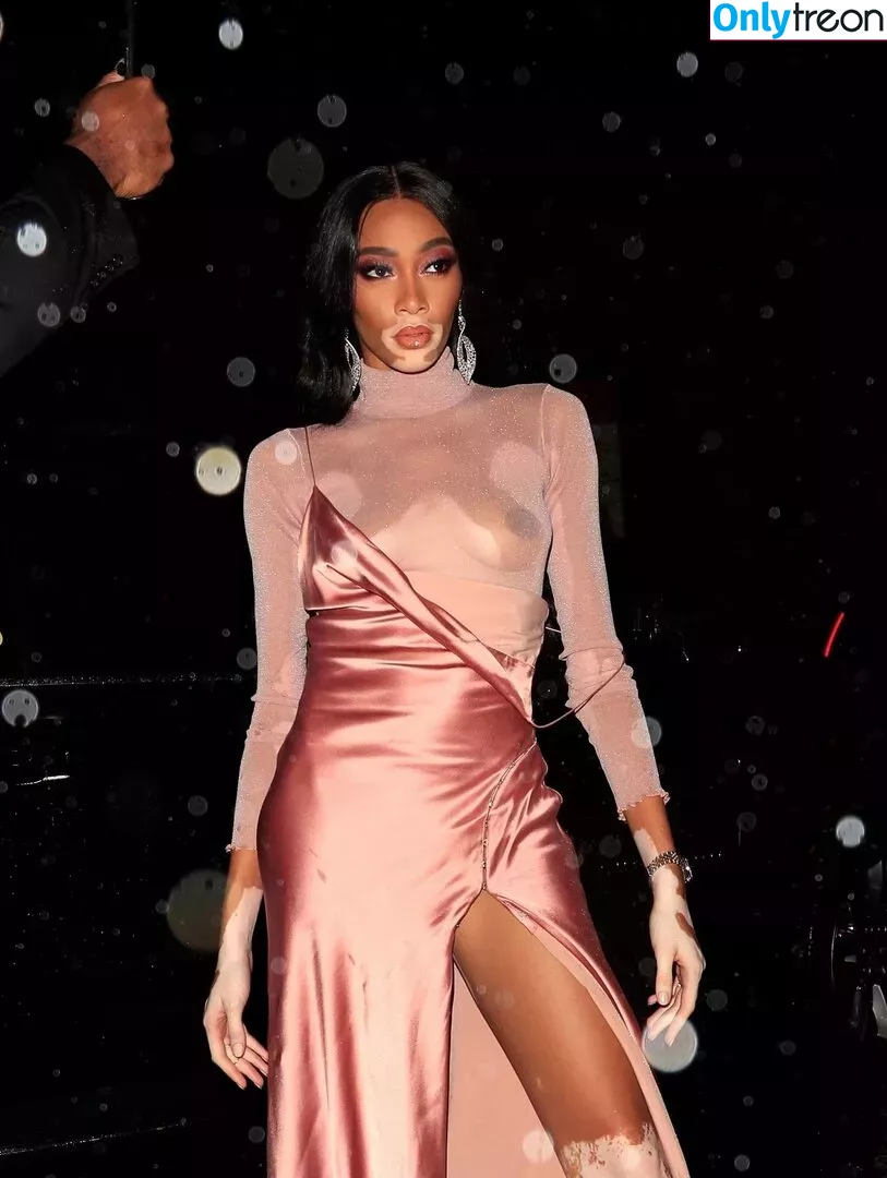 Winnie Harlow nude photo #0198 (winnieharlow)