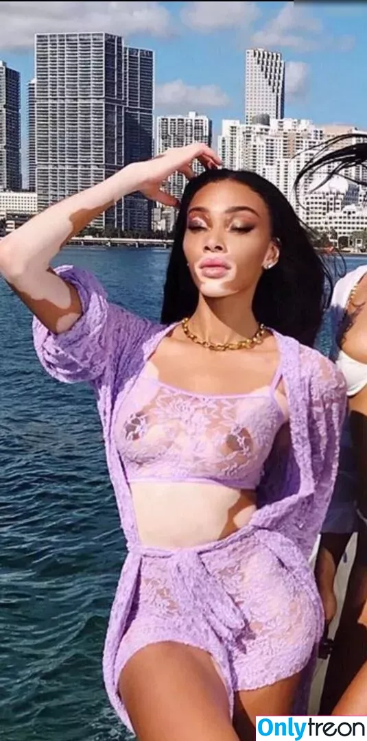 Winnie Harlow nude photo #0199 (winnieharlow)