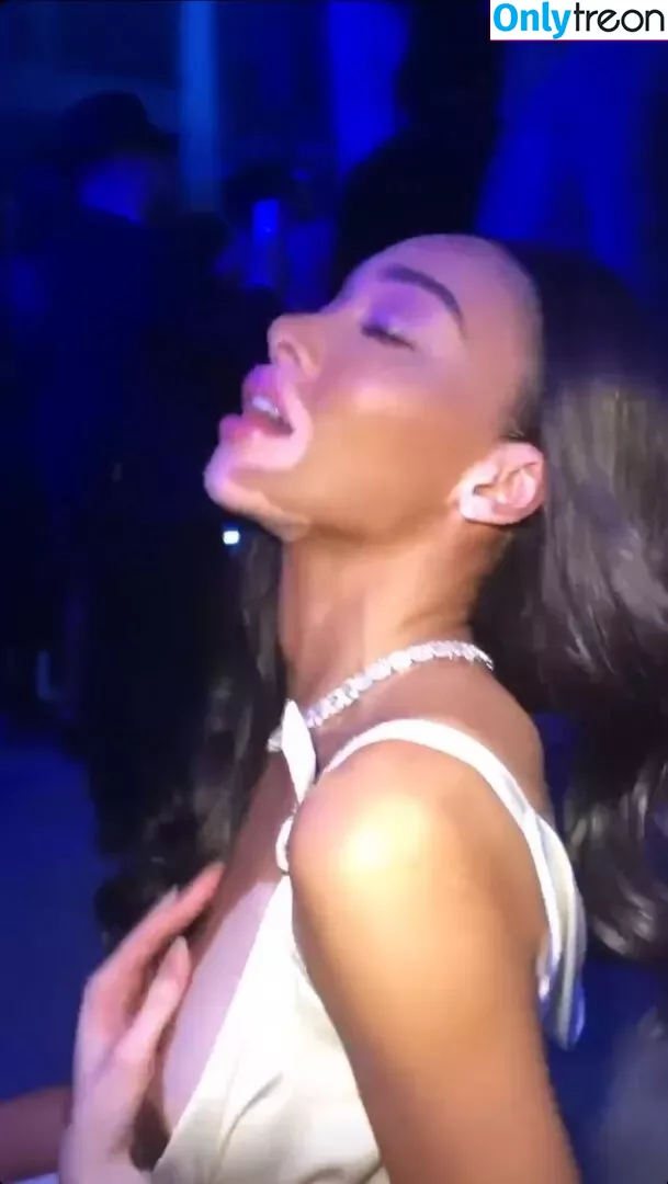 Winnie Harlow nude photo #0201 (winnieharlow)