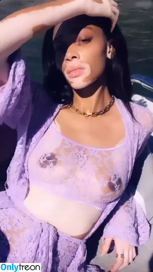 Winnie Harlow nude photo #0203 (winnieharlow)