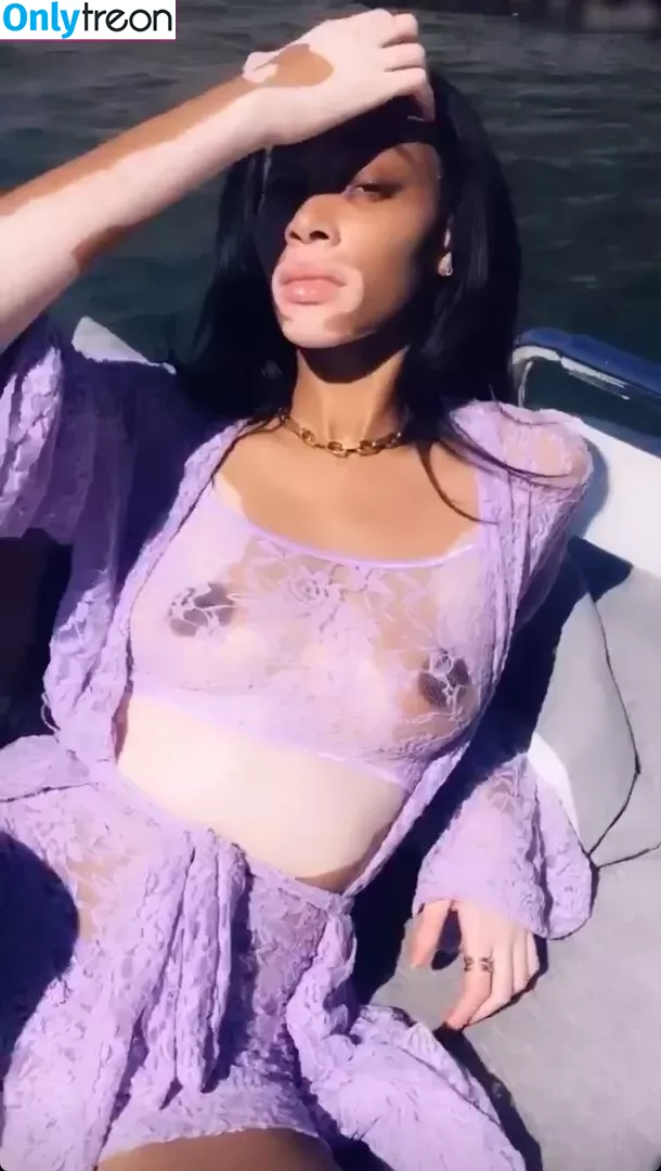 Winnie Harlow nude photo #0204 (winnieharlow)