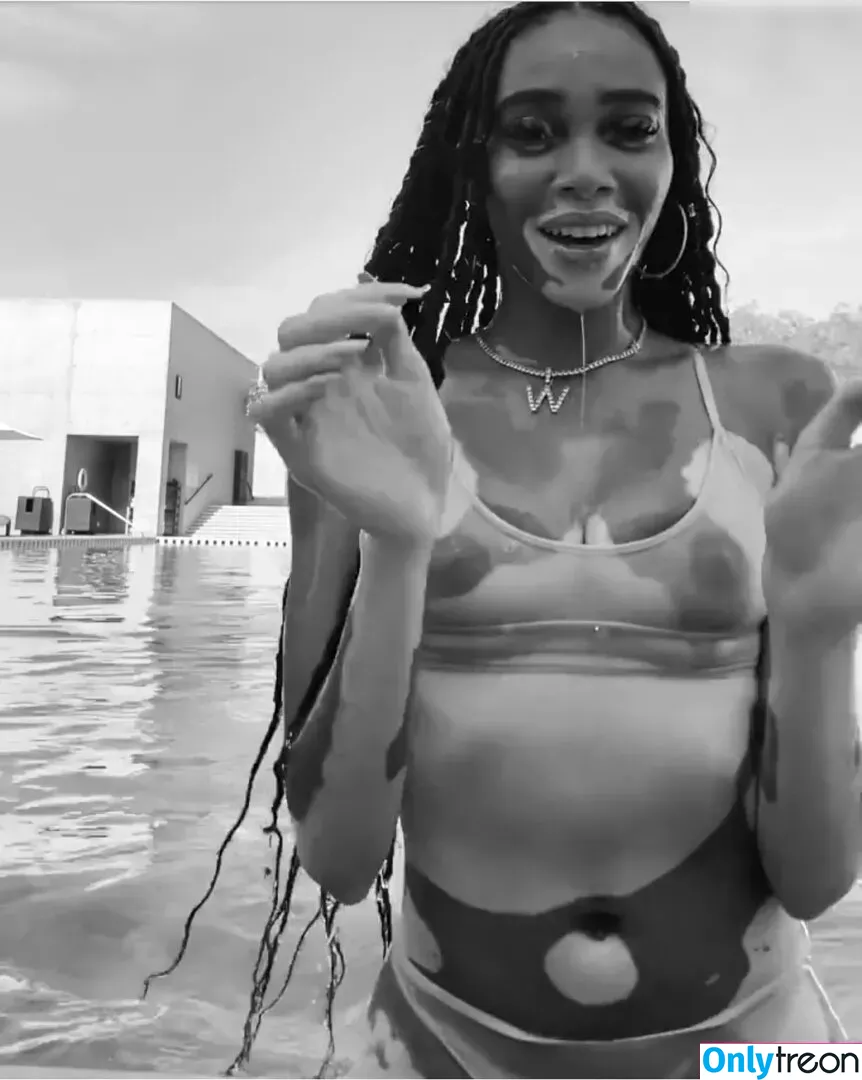 Winnie Harlow голая photo #0216 (winnieharlow)