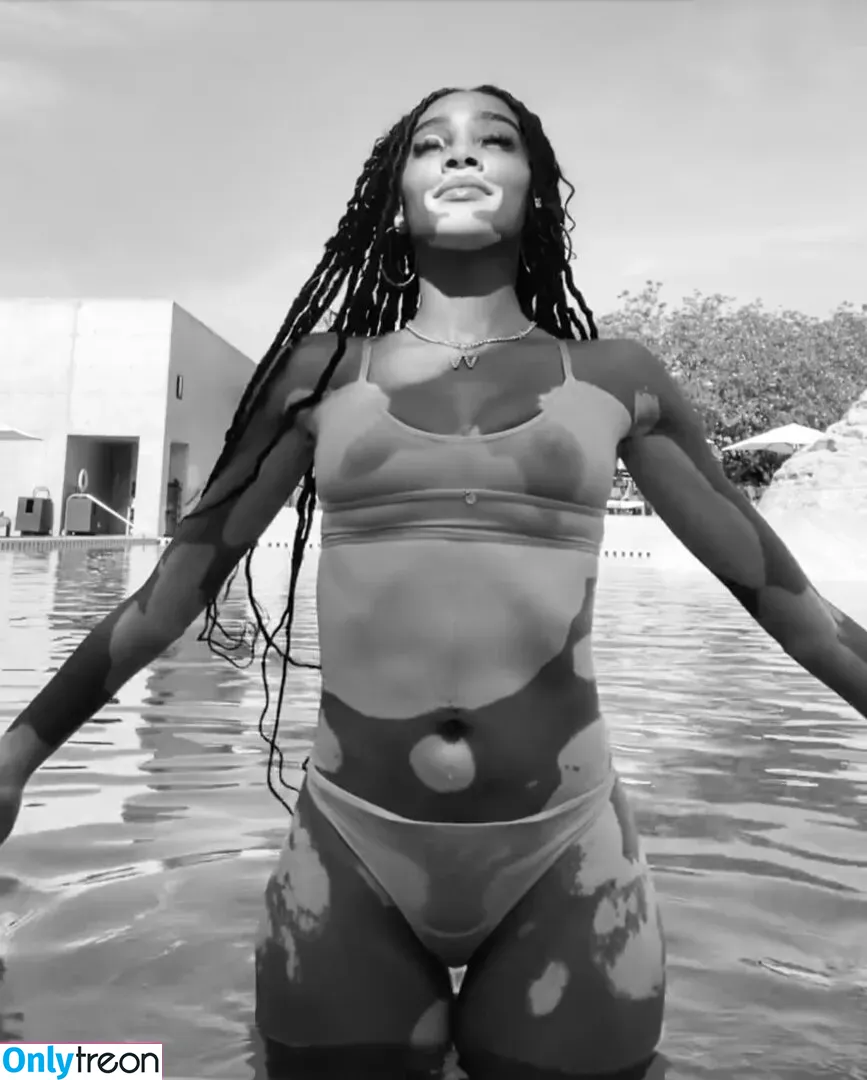 Winnie Harlow голая photo #0217 (winnieharlow)