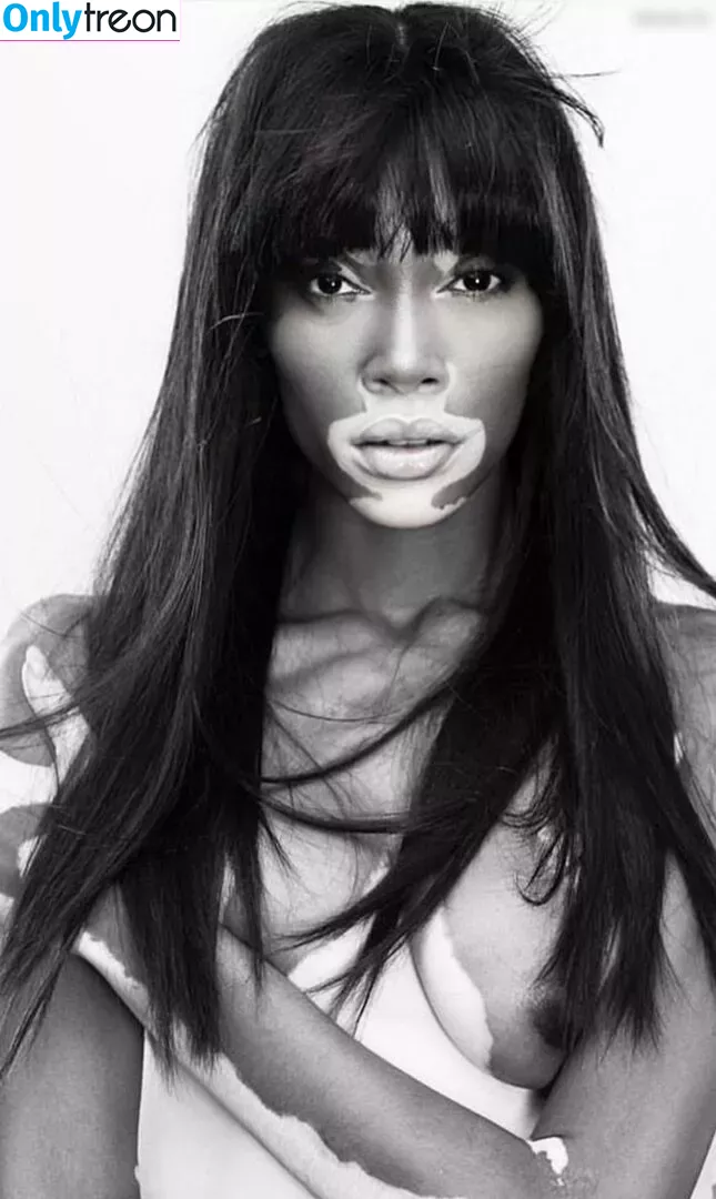 Winnie Harlow nude photo #0219 (winnieharlow)