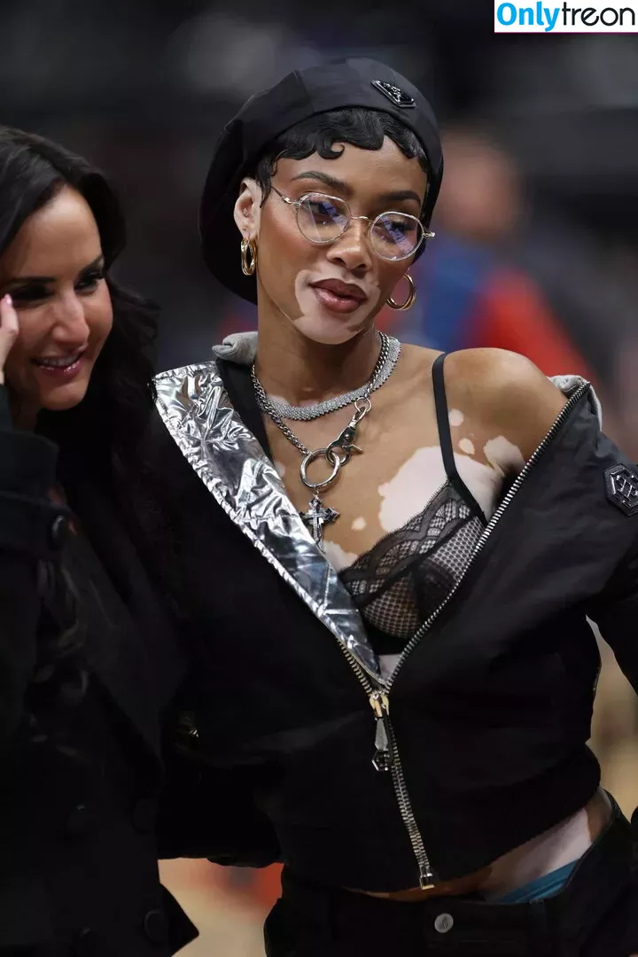 Winnie Harlow nude photo #0222 (winnieharlow)