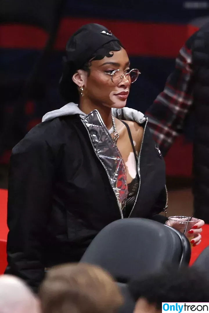 Winnie Harlow nude photo #0227 (winnieharlow)