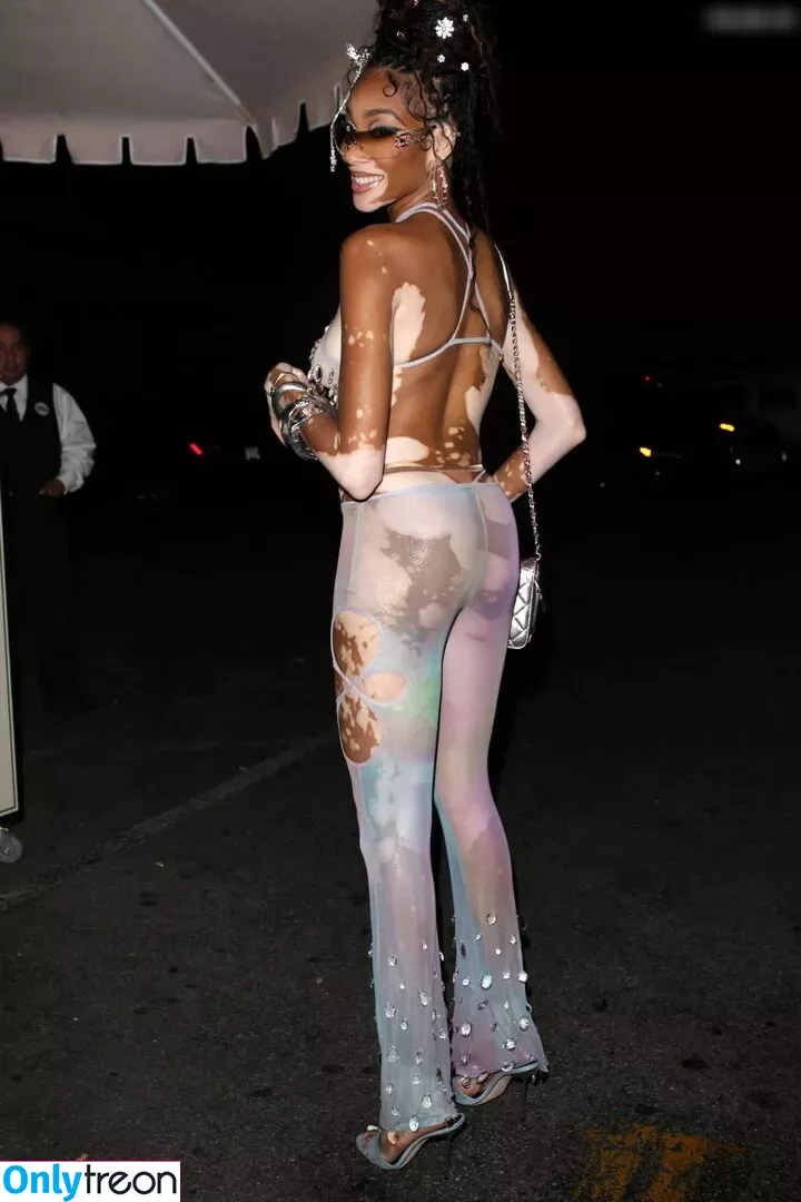 Winnie Harlow nude photo #0233 (winnieharlow)