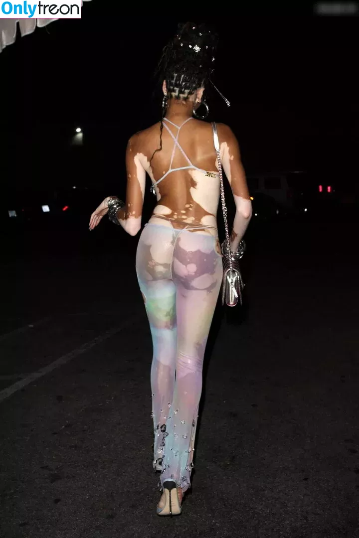 Winnie Harlow nude photo #0234 (winnieharlow)