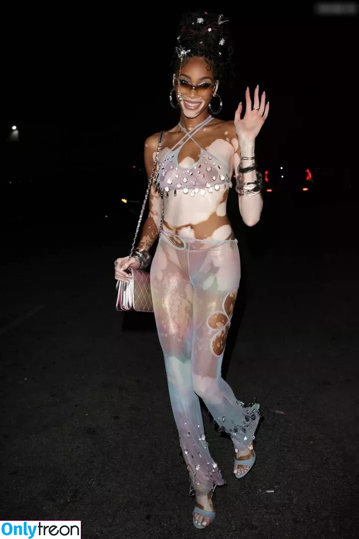 Winnie Harlow nude photo #0236 (winnieharlow)