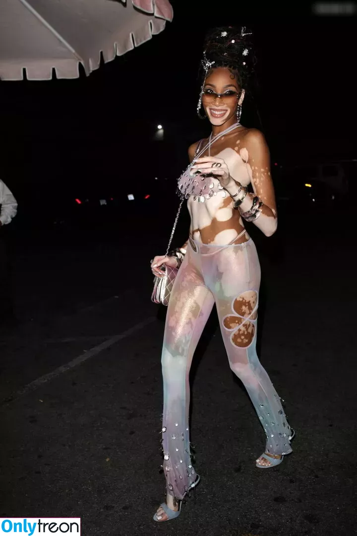 Winnie Harlow nude photo #0237 (winnieharlow)